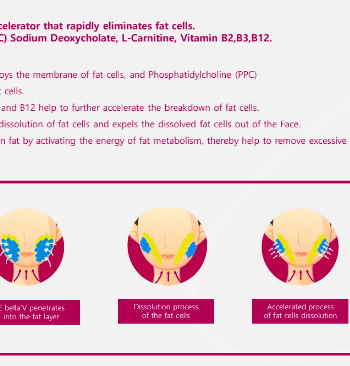 E bella V sodium deoxycholate solution