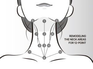 SAVE B32 injection points