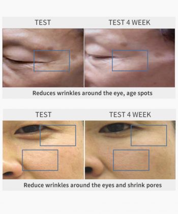 Dermaline PDX exosome PDRN Skin Booster