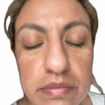 VITARAN A 2.5% Retinol Serum with PDRN 30ml photo review