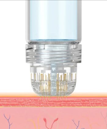 hydra needle microneedling