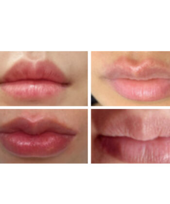 Priere tulip booster